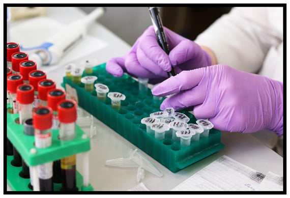 Are Blood Tests Important?